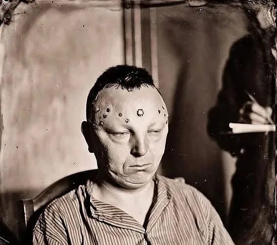 убийство под маската на медицина: трагедията на джеймс и цената на „нормалността“